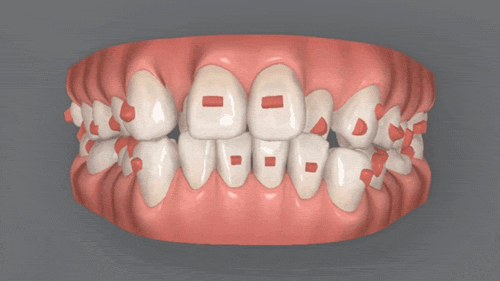 最適な治療計画をご提案します