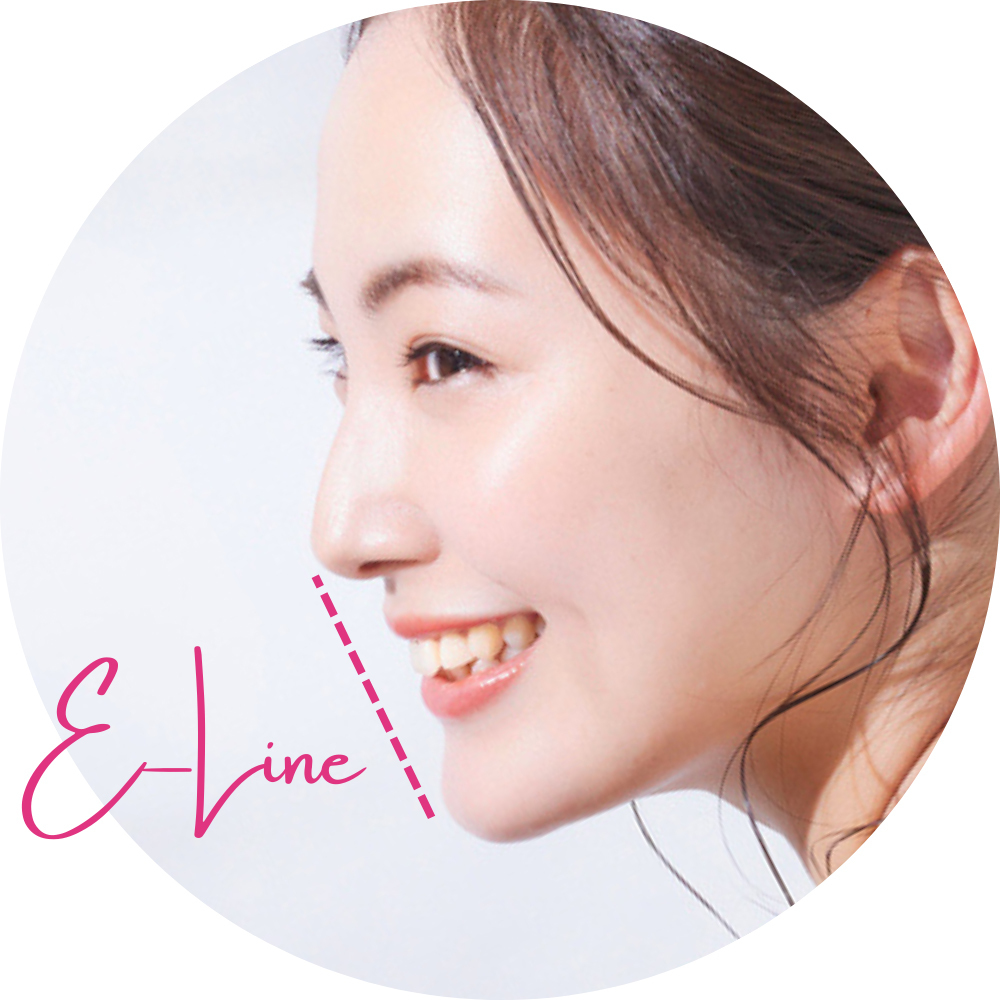 前歯だけを動かす矯正で失敗 - 新発田矯正歯科相談室