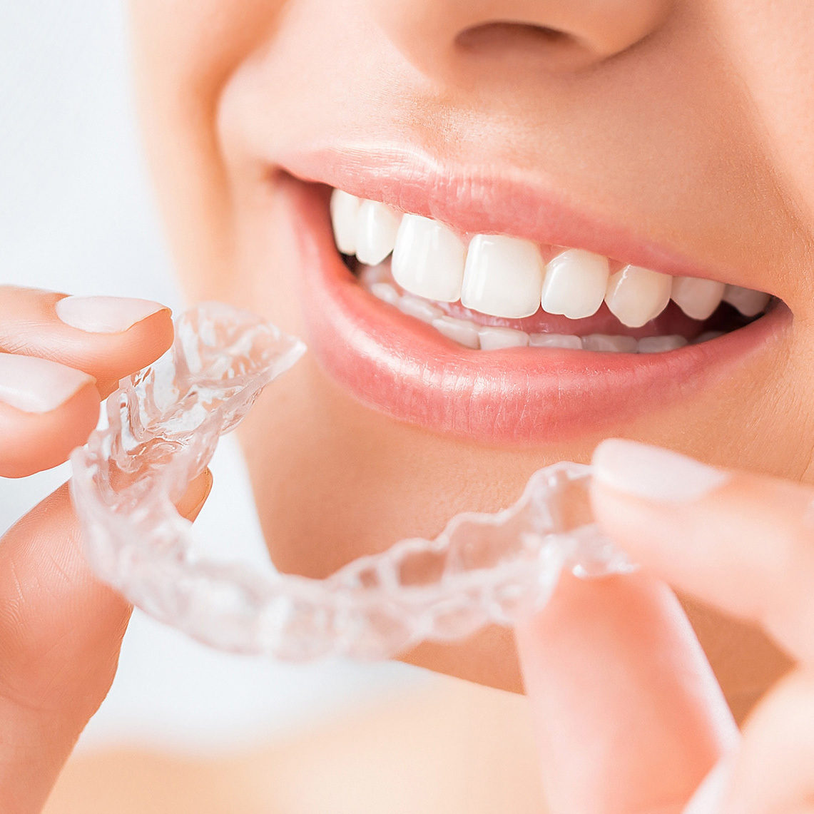 マウスピース矯正 インビザラインの費用